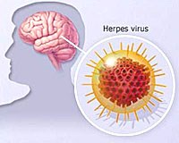 Điểm báo về các vấn đề liên quan đến y tế từ ngày 4/7 đến 5/7 năm 2014 