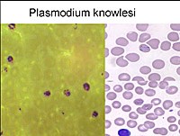 Dịch tễ học phân tử ký sinh trùng sốt rét truyền từ khỉ sang người Plasmodium knowlesi