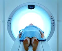 Tia xạ điều trị ung thư có thể gây hại tiêu hóa