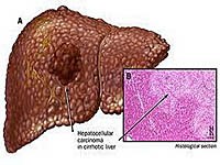 Điểm báo về các thông tin liên quan đến y tế ngày 20/7 và 21/7 năm 2014