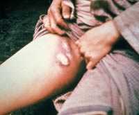 Trung Quốc phong tỏa và cách ly khu vực dân cư xuất hiện bệnh dịch hạch