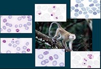 Thách thức trong chẩn đoán ký sinh trùng sốt rét Plasmodium knowlesi lan truyền từ khỉ sang người (phần 2)