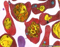 Cần có “hành động triệt để”  với sốt rét kháng thuốc