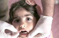 Chiến dịch chủng ngừa bại liệt hàng loạt đang được tiến hành ở Iraq 