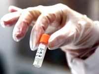 Thuốc ZMapp điều trị virus Ebola “đạt hiệu lực 100%” ở thử nghiệm trên động vật