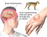 Bệnh dại tử vong cao nhưng có thể phòng tránh được