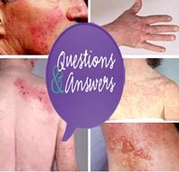 Giải đáp bạn đọc về các kiến thức chuyên ngành ký sinh trùng và côn trùng truyền bệnh tháng 9 năm 2014 (Phần 2)