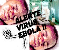 Dịch tễ học bệnh Ebola-những dấu mốc đáng chú ý
