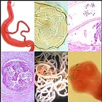 Tổ chức Y tế thế giới cảnh báo phải loại trừ 7 căn bệnh nhiệt đới bị lãng quên 