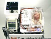 Bác sĩ phẫu thuật cấy ghép tim đã ngừng đập