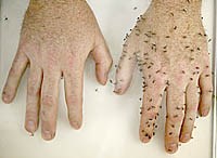 Một số phát hiện mới về tác nhân diệt côn trùng