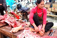 10 sự kiện về nang sán thần kinh