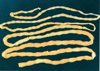 Sán dây được tìm thấy sống bên trong não của bệnh nhân: loại bỏ sán dây và xét nghiệm chuỗi trình tự gen