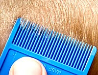 Bệnh do rận mu Pthirus pubis đi kèm số bệnh lây truyền qua đường tình dục 