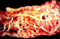 Một số ấn phẩm nghiên cứu về ký sinh trùng đường ruột gần đây trên y văn thế giới