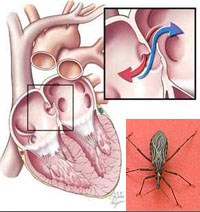 Những điều chưa biết về lịch sử bệnh Chagas