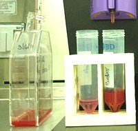 Nghiên cứu nuôi cấy ký sinh trùng sốt rét Plasmodium vivax còn nhiều thách thức