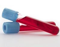 Test xét nghiệm máu nhanh chóng giúp  cắt sử dụng kháng sinh 