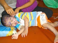 Điểm tin y tế từ các báo ngày 4/4 đến 6/4 năm 2015