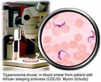 Nhân trường hợp nhiễm ký sinh trùng hiếm gặp Trypanosoma evansi đầu tiên ở Việt Nam-Tổng hợp y văn và thông tin cập nhật toàn cầu