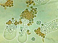 Lưu ý bệnh amíp ngoài đại tràng