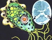 Đề phòng viêm màng não-não khi tắm và bơi lội chỗ nước bẩn  