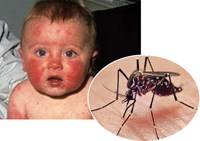 Cập nhật thông tin mới nhất về về dịch bệnh truyền nhiễm virus Zika do muỗi truyền