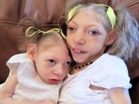 Phòng ngừa bệnh sốt do vi-rút Zika ngoại nhập 