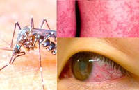 Điểm tin y tế từ các báo ngày 19/2 đến 24/2 năm 2016