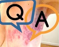 Trả lời câu hỏi bạn đọc về chuyên ngành ký sinh trùng và kiến thức y học phổ thông tháng 12/2015 đến tháng 2/2016 (Phần 1)  