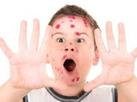 Điểm tin y tế từ các báo ngày 29/3 đến 31/3 năm 2016