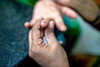 10 sự thật về bệnh tiểu đường