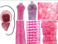 Một số tin tức-sự kiện quốc tế về ký sinh trùng ở người có thể bạn quan tâm