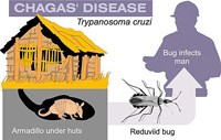 Bệnh Chagas (American trypanosomiasis)