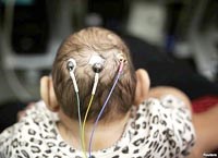 Các chuyên gia Hoa Kỳ cảnh báo mùa muỗi hoạt động mạnh là mùa truyền bệnh Zika