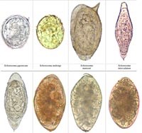 Cập nhật thông tin chẩn đoán và điều trị bệnh sán lá gan lớn Fasciola hepatica và Fasciola gigantica ở người (Phần 2)