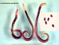 Cảnh báo một số ca bệnh nhiễm trùng hệ thần kinh trung ương do ký sinh trùng 