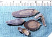 Tổng hợp công trình nghiên cứu về sán lá gan lớn Fasciola hepatica và  Fasciola gigantica: nhiều vấn đề còn bỏ ngỏ