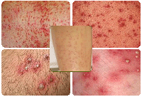 Hỏi đáp về y học thường thức và kiến thức chuyên ngành tháng 8 năm 2016 (Phần 2)