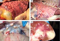 Bệnh Melioidosis hay Withmore do vi khuẩn Burkholderia pseudomallei nguy hiểm ở người hiện nay