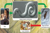 Bệnh viên màng não do giun Angiostrongylus cantonensis  ký sinh ở người