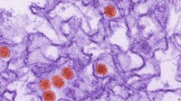 WHO: Dự báo virus Zika ​​sẽ lây lan trong khu vực Châu Á-Thái Bình Dương