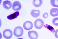 Sự `thờ ơ` của Chính phủ làm gia tăng sốt rét tại Venezuela