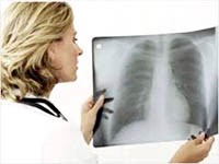 Hoa Kỳ cho phép thử nghiệm lâm sàng vaccine ung thư phổi của Cuba