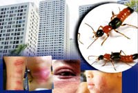 Điểm tin y tế ngày 24/10 đến 25/10 năm 2016