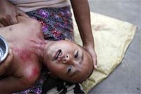 Những thách thức lớn khi Ấn Độ hướng tới loại trừ sốt rét vào năm 2030