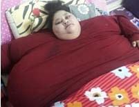 Bác sĩ Ấn Độ phẫu thuật cho bệnh nhân người Ai Cập nặng “500kg”