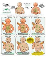 Sử dụng các hình ảnh minh họa cải thiện sự tuân thủ điều trị bệnh sốt rét tại Suriname