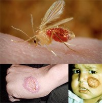 Nhiễm đơn bào Leishmania spp: Bệnh truyền nhiễm nguy hiểm năm 2017 (Phần 1)