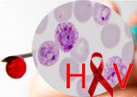 Đồng nhiễm sốt rét-HIV và ngược lại làm cho bệnh nặng hơn? (Phần 1)